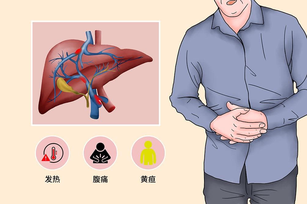 脓毒血症诊断标准