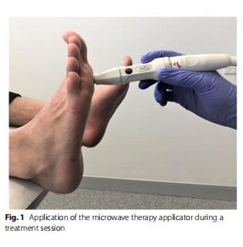J Foot Ankle Res：微波疗法治疗跖疣的疗效