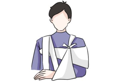 肩关节脱位知多少