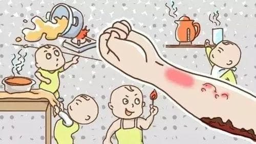 孔令凯医生教你正确处理宝宝烫伤