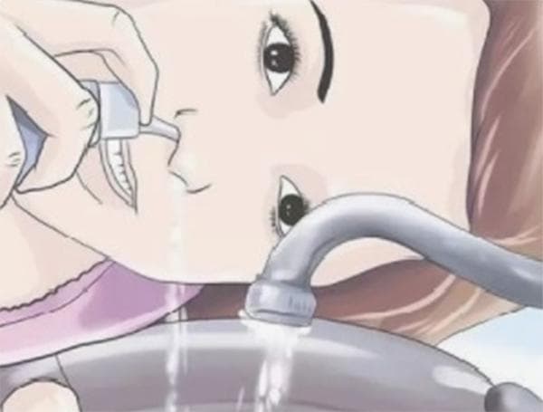 【眼科医院健康科普】流鼻涕，该如何正确擤