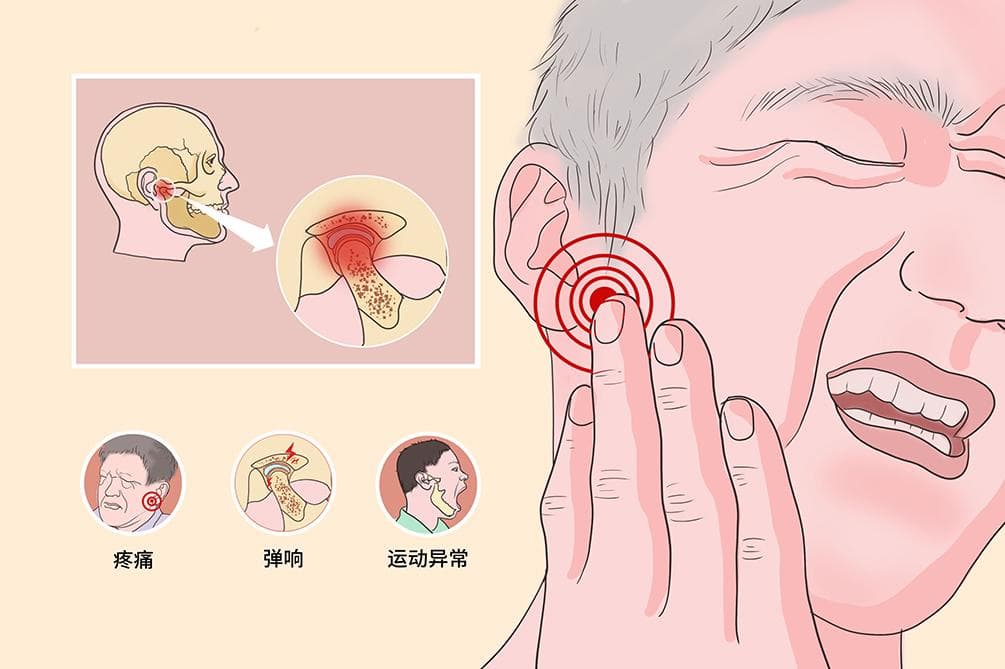 左脸下颌线下方疼？可能是这5种原因