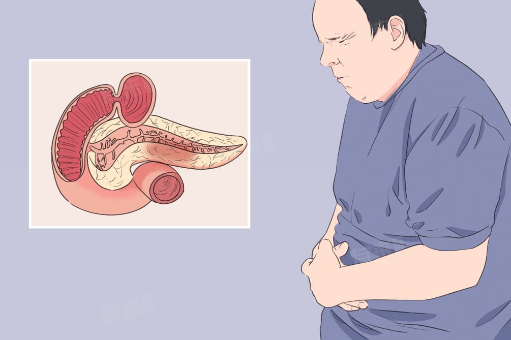 慢性胰腺炎饮食方面要怎么注意