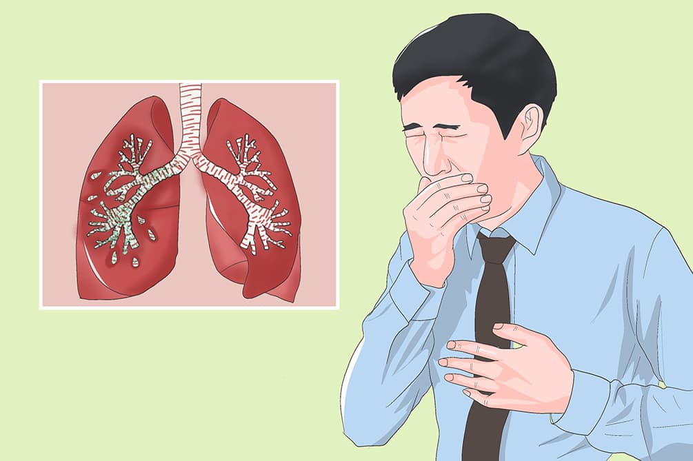 支气管扩张的五类常用药物