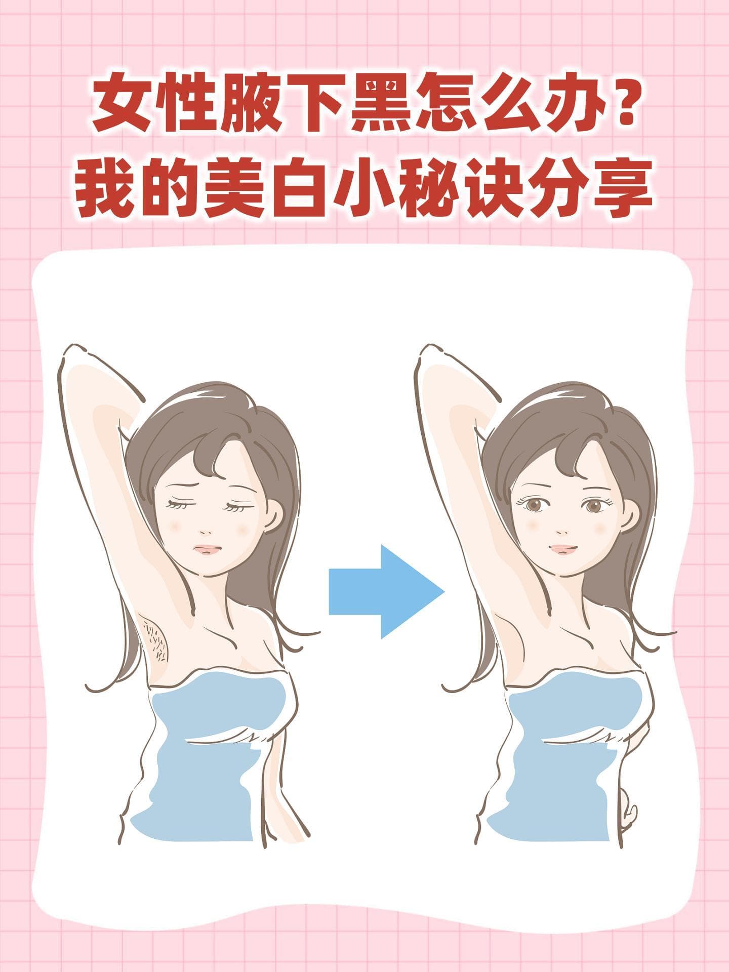 女性腋下黑怎么办？实用美白小秘诀分享