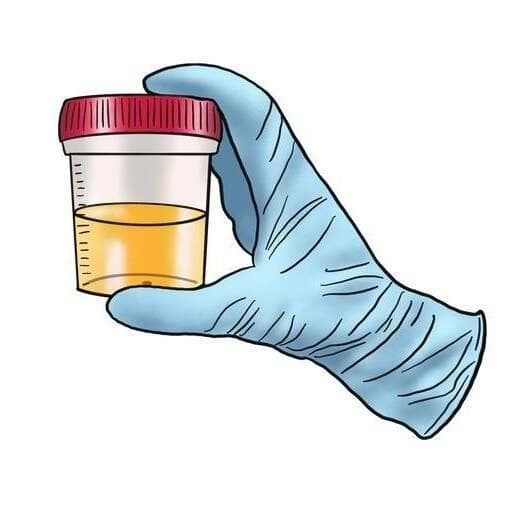 尿液"越清越好"吗？ 泌尿外科专家：健康小便有4个标准！