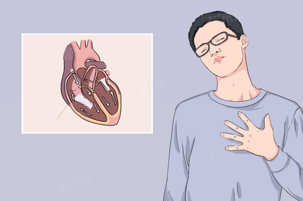 预激综合征治疗最佳方法