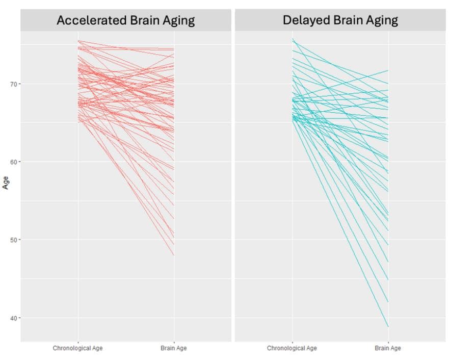 揭秘大脑不老秘诀！npj Aging：特定的营养物质或能减缓大脑衰老