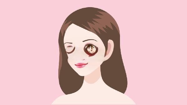 激光祛斑后注意什么好，如何保养雀斑不反弹？
