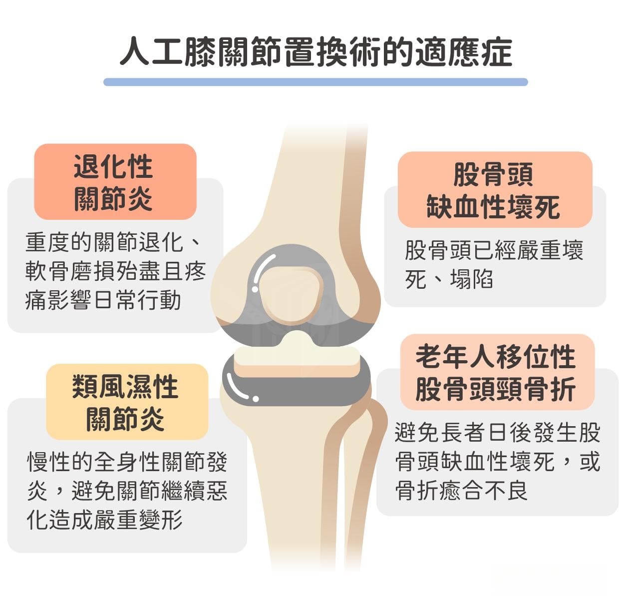 膝关节置换术的风险与注意事项：从术前准备到术后康复的全方位指南