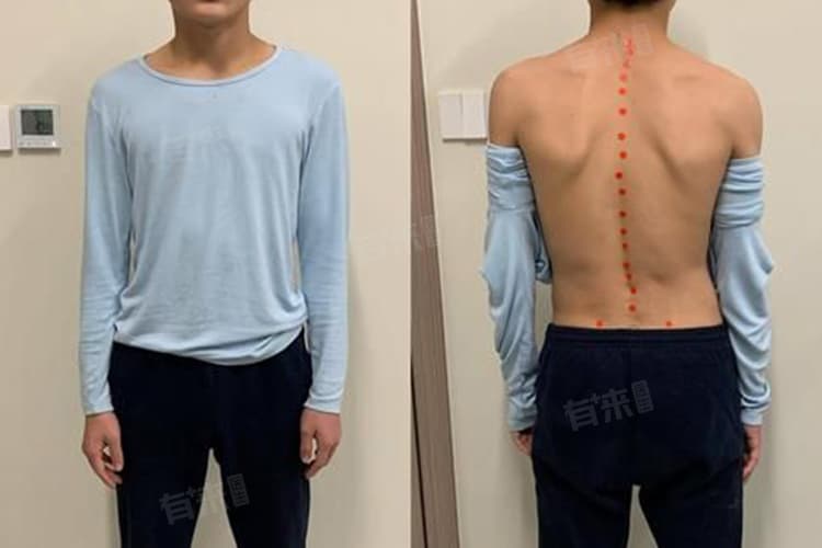 缺钙症状全解析：从骨骼到心血管的健康警示