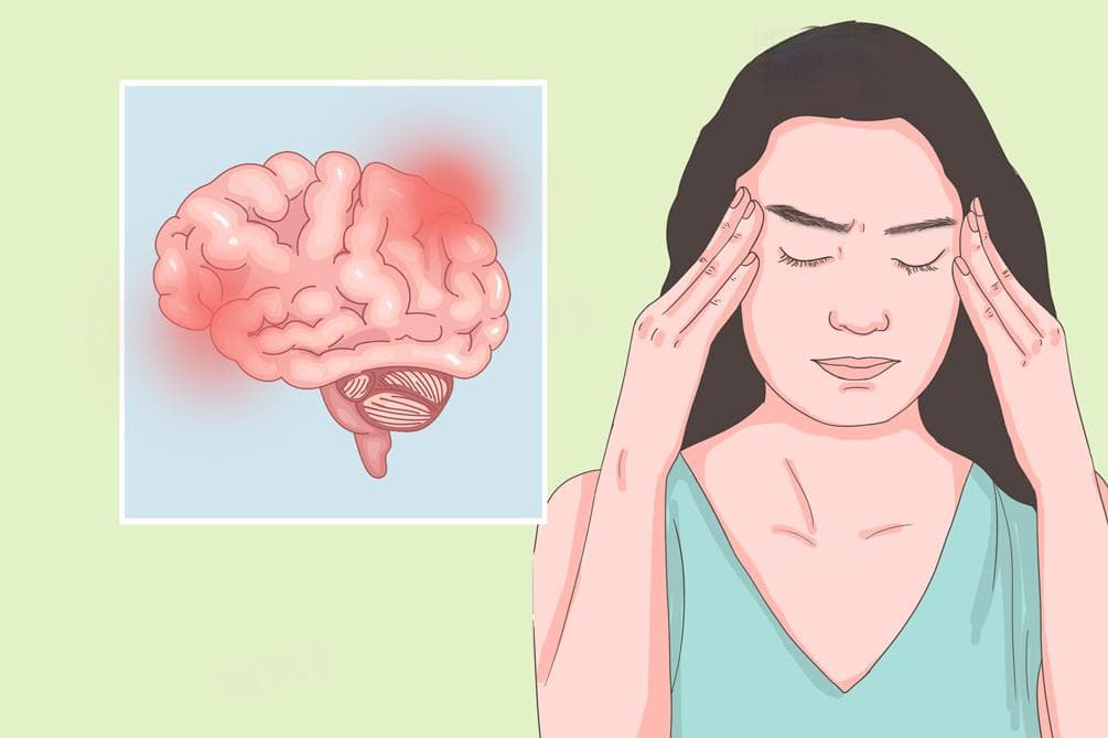 偏头痛的治疗方法全解析：药物治疗与非药物治疗双管齐下