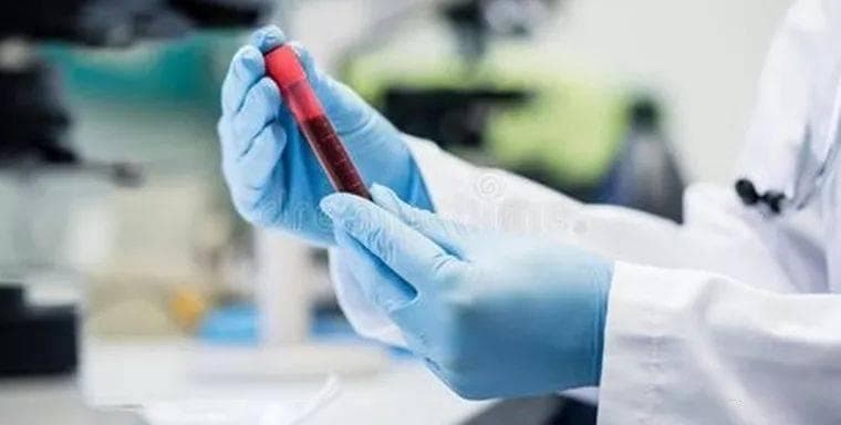 血肌酐都这么高了:用什么药能降肌酐?医生说了大实话