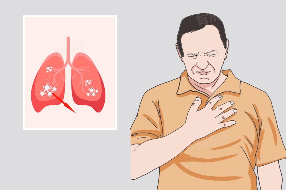 肺吸虫病的症状、治疗和预防