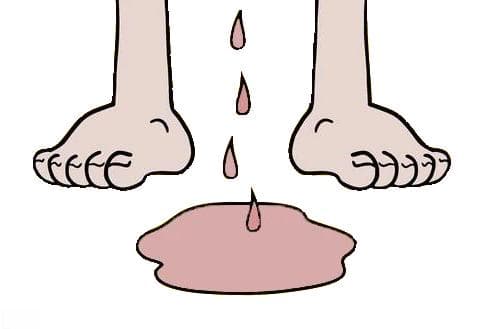 【健康科普】肉眼血尿：不容忽视的身体信号