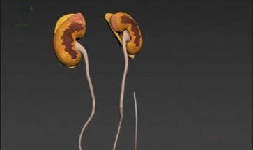 这7种常见食物，正在悄悄伤害你的肾