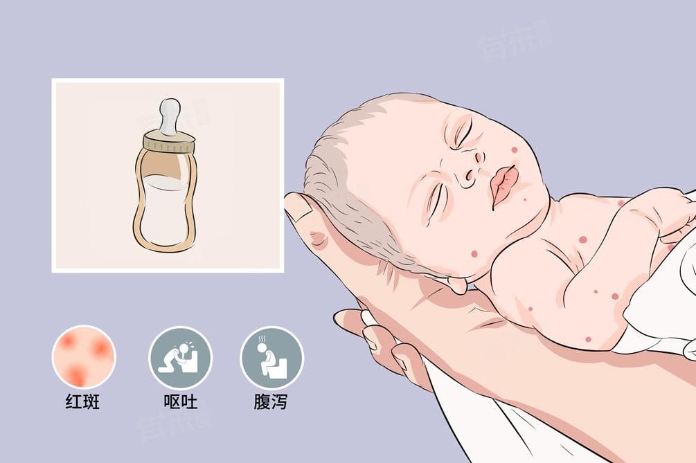 牛奶过敏怎么办？原因、症状及解决方案全解析