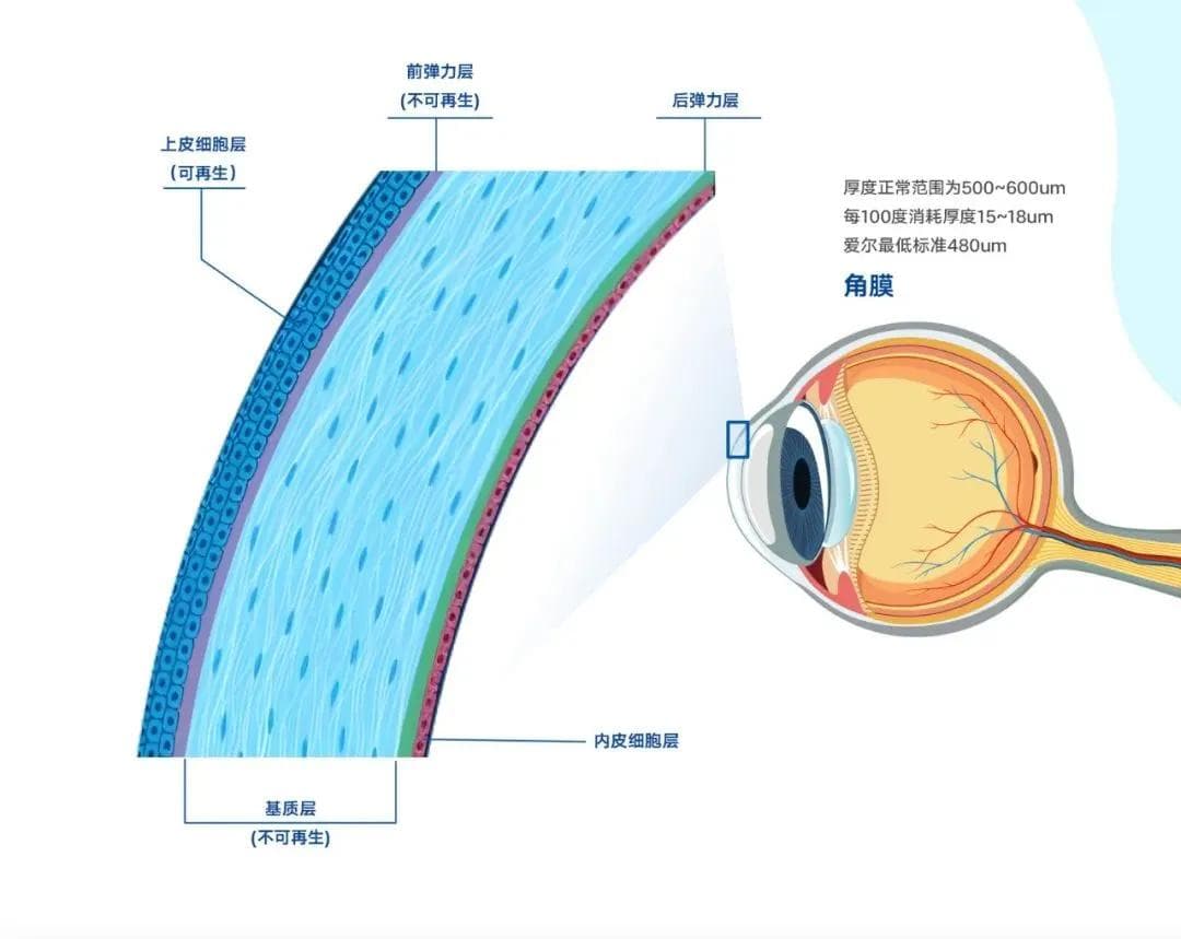 全飞秒 VS 半飞秒，究竟哪个好？