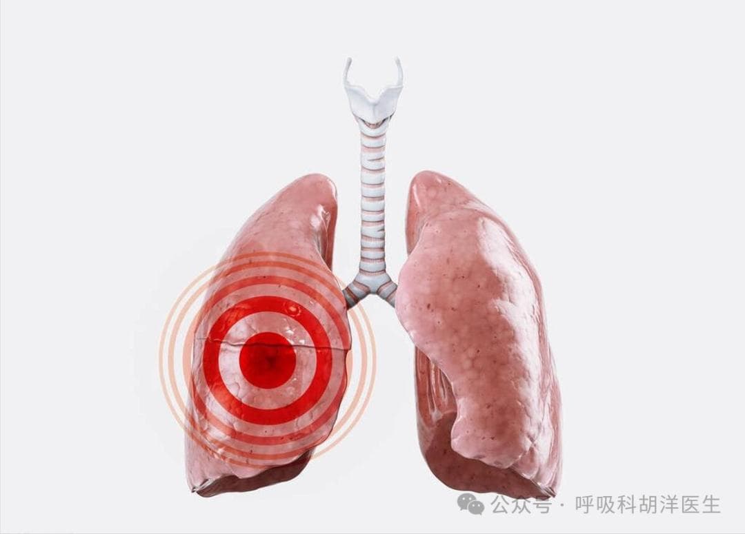 要想肺少生病，以下几点必须要做到，每个普通人都能做到