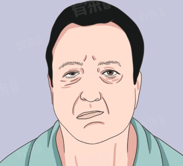面瘫挂什么科治疗最好