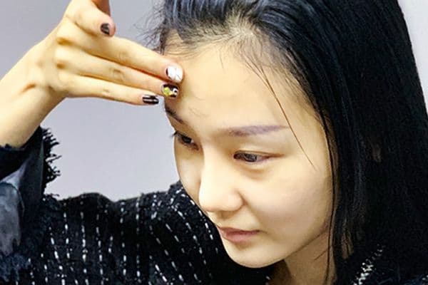 皮肤补水全攻略：从护肤品到生活习惯的全方位护理方案