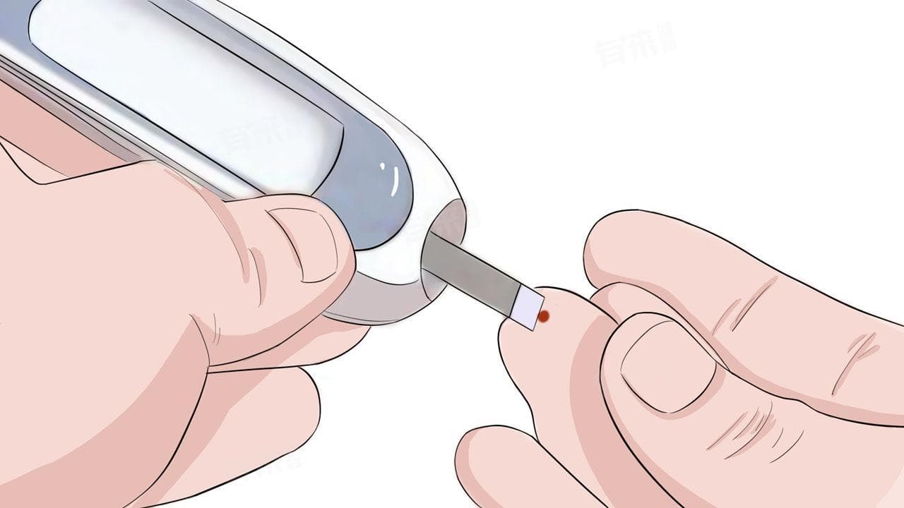 血糖血脂检查项目全解析