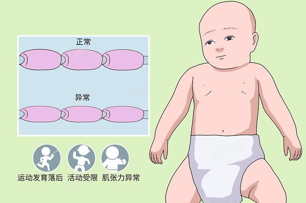 脑白质脱髓鞘改变：原因、治疗与就诊指南
