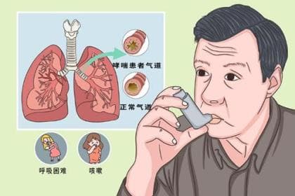 世界防治哮喘日：全面了解哮喘的临床表型、日常管理与预防措施