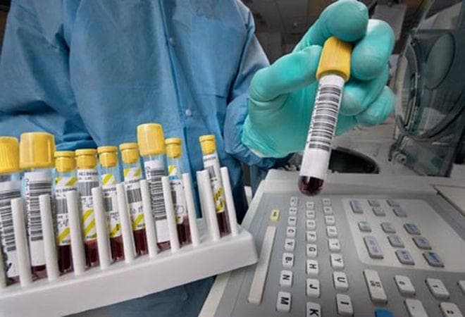 献血复检HIV核酸：守护爱心，确保血液安全