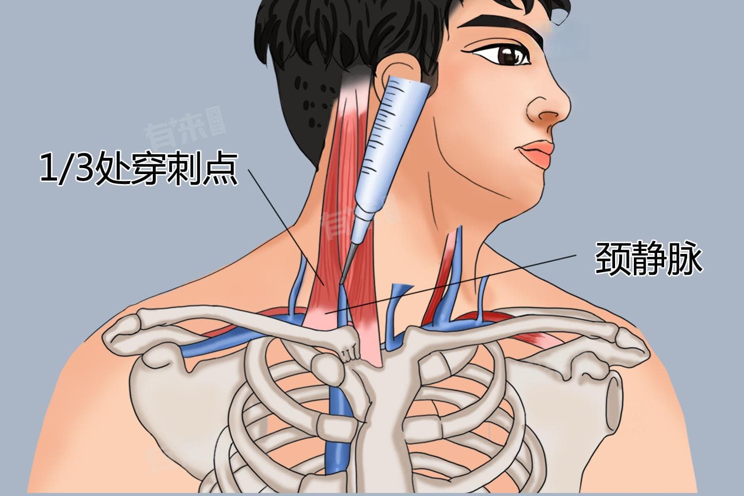 做穿刺需要多少钱一次