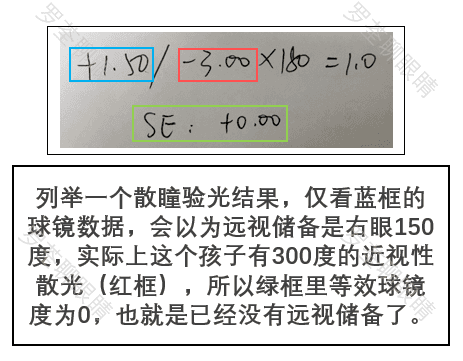 不散瞳没办法测远视储备！想起来才去测，是没有用的
