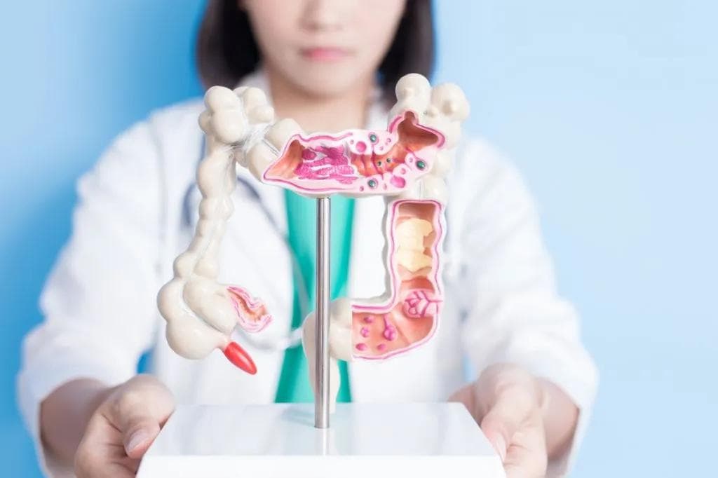 为什么有的人总长肠道息肉？医生忠告：4种食物要少碰
