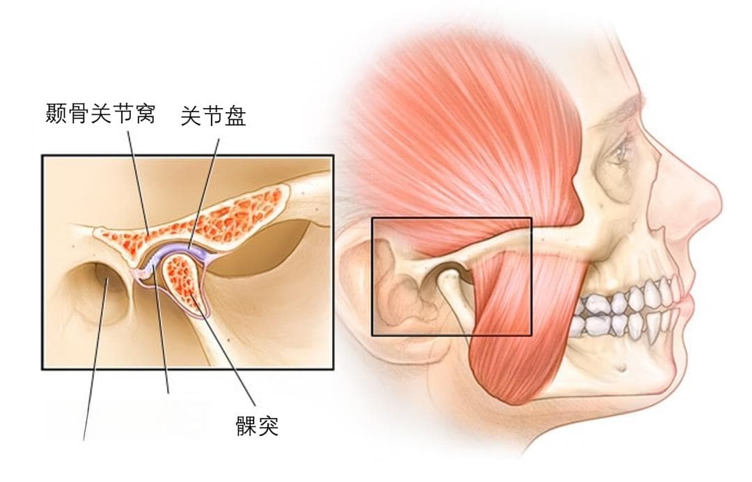 颞下颌关节紊乱还耳鸣，可能是躯体化+中枢敏化惹的祸！