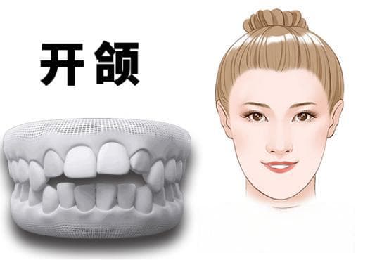 牙齿修复技术大揭秘：三种主流方法的优缺点对比
