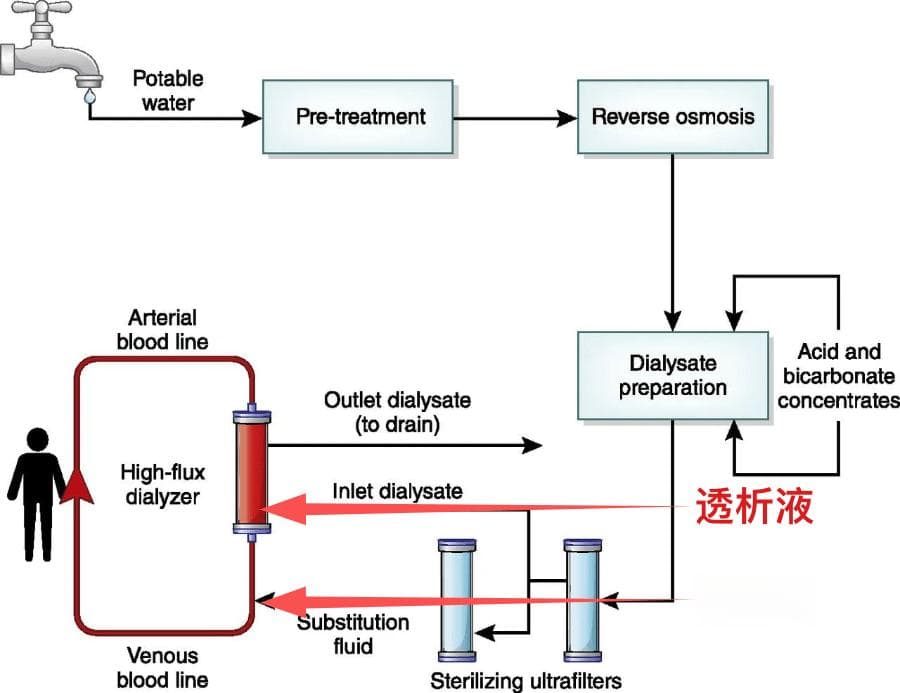 血液透析之置换液解析