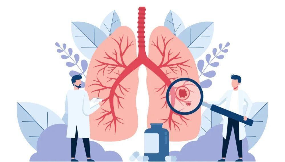 病毒性、细菌性、真菌性，这3种肺炎傻傻分不清楚