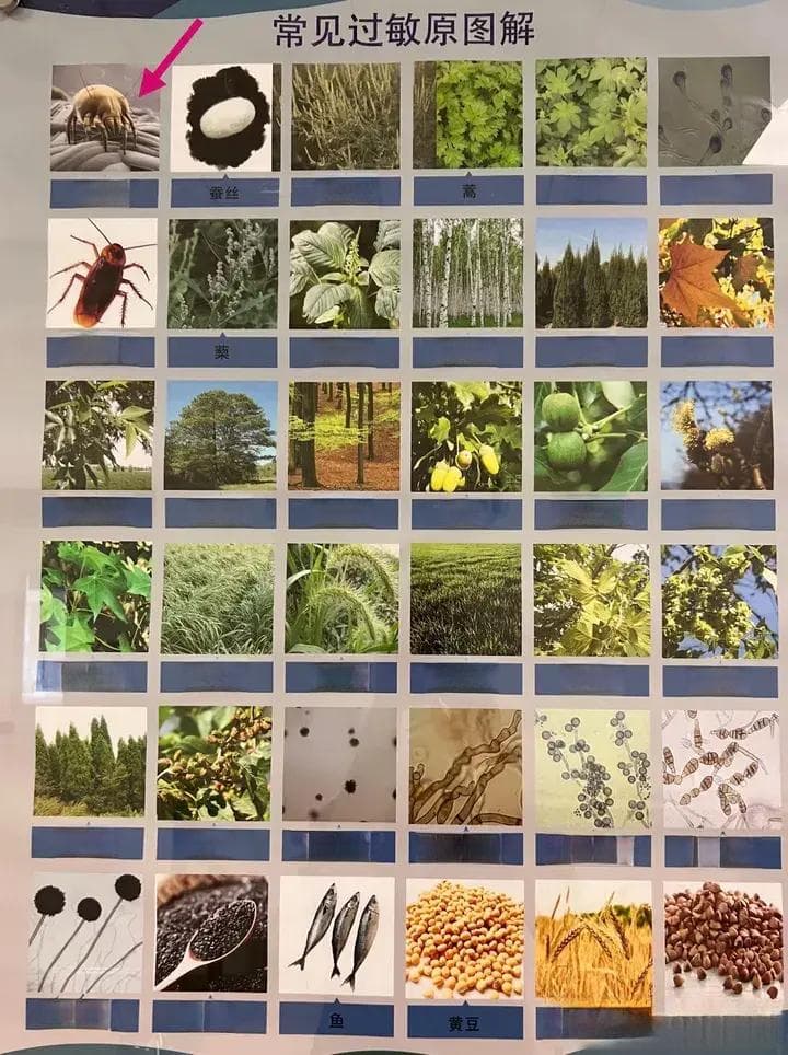 告别尘螨困扰！打造过敏友好型家居的实用指南
