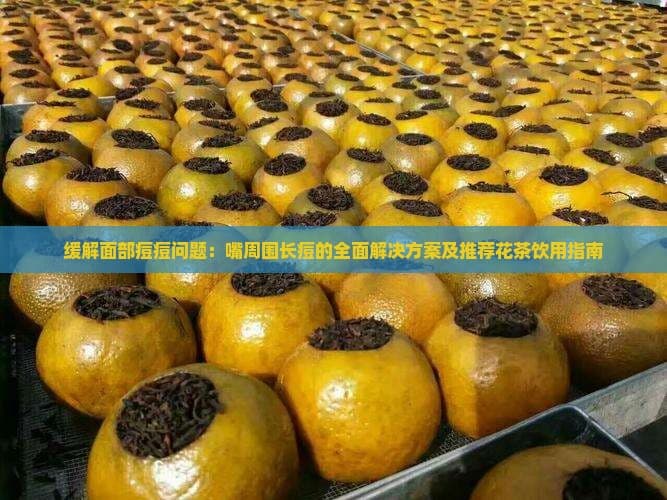 嘴周长痘怎么办？全方位解决方案及花茶调理指南