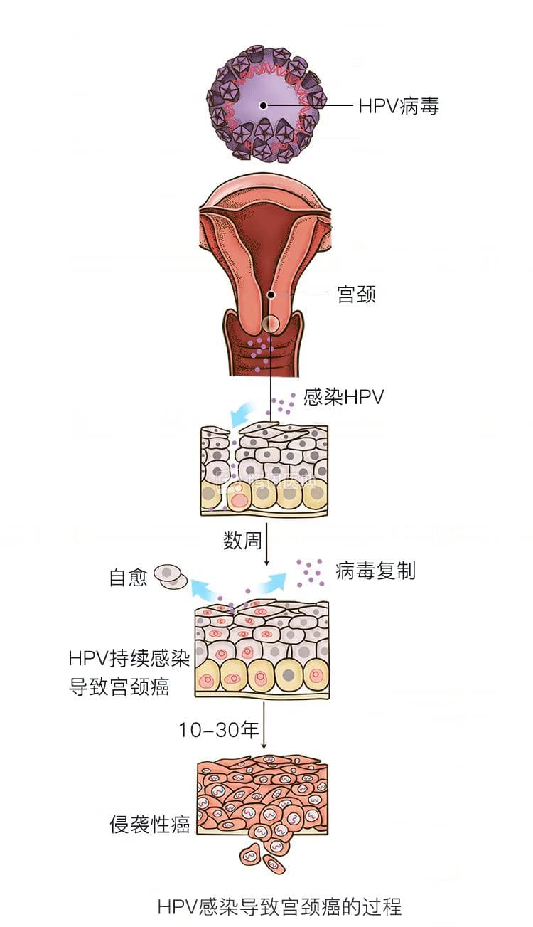 不想得妇科病，一定要做好这些预防措施