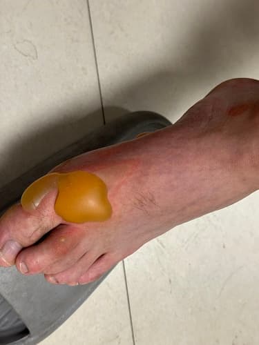 化学实验很新奇，安全问题应注意