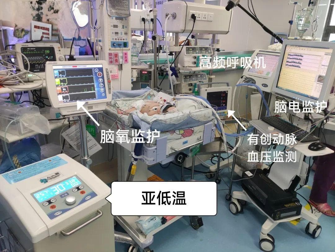 72小时逆转危局！亚低温技术让重度窒息新生儿重燃生机！
