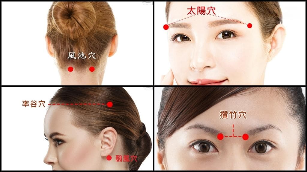 中医双管齐下治疗偏头痛：中药针灸配合穴位按摩
