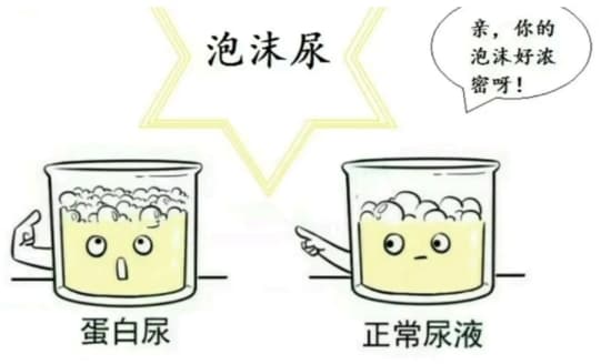 小便发黄、泡沫尿，就是有肾病吗？