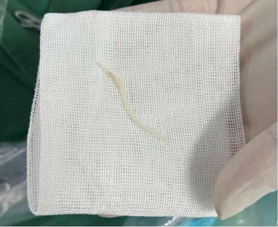 【健康科普】老年人饮食安全：鱼刺卡喉的预防与应对指南