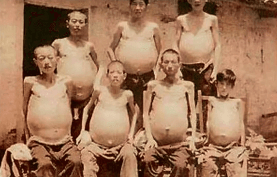 为什么你不能喝生水，动物都直接喝？