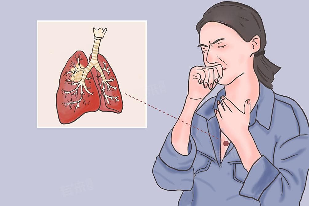 肺腺癌有哪些特征