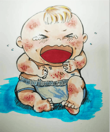 “食物过敏”知多少？
