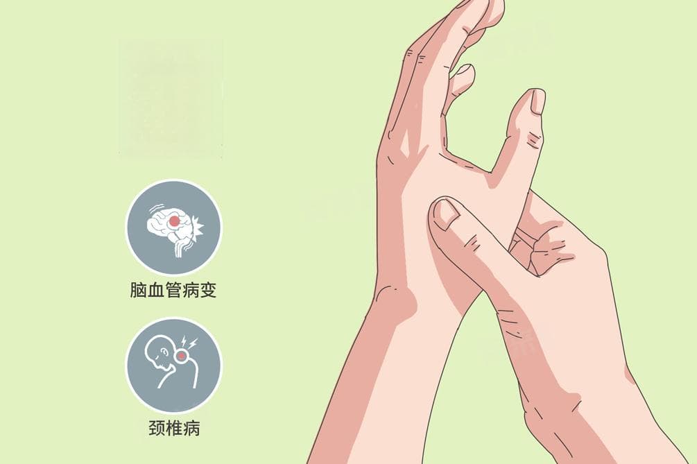 手指麻木是怎么回事