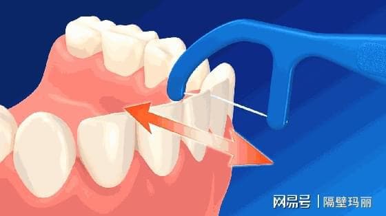 牙线的四大好处：揭秘牙线在口腔清洁中的重要作用