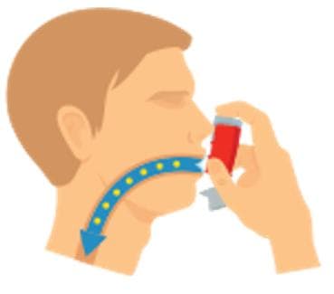 慢阻肺患者稳定期如何做好居家管理？